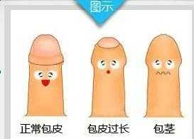 ��������Ƥ����