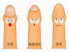 ��Ƥ����ʱ��