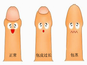 ��Ƥ����Σ��