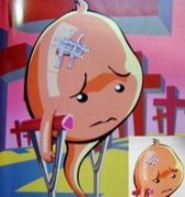 ����֢ԭ��