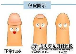 重庆曙光男科医院