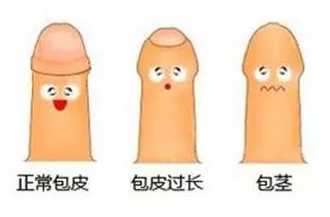 ������Ҫ���Ƥ��